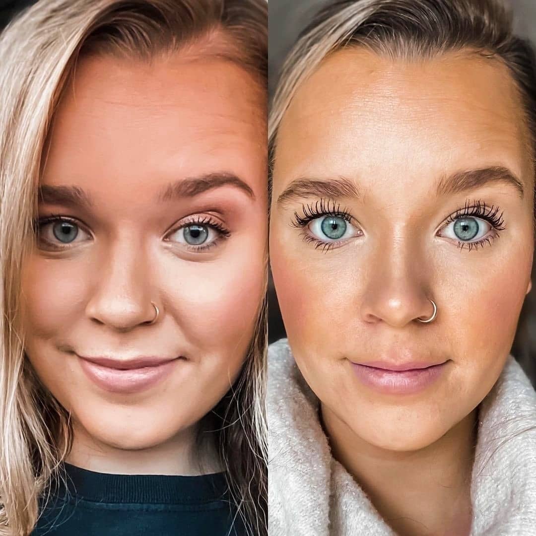 Lash Therapy